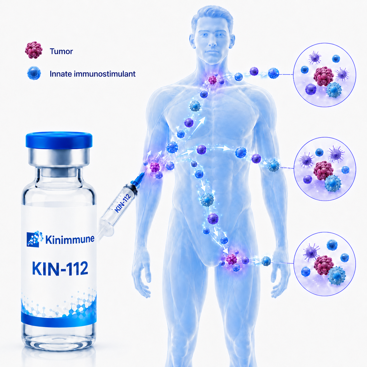 KIN-112 injected locally, engaging the tumor and distributing toward a systemic antitumor response